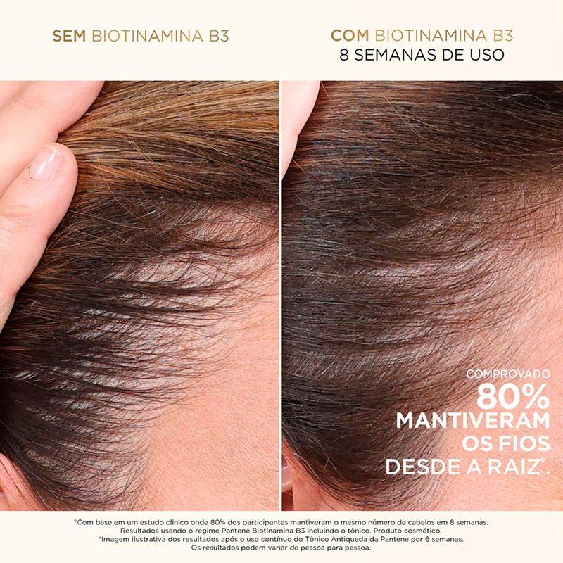 SHAMPOO PANTENE BIOTINAMINA B3 175ML