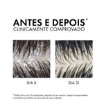 VICHY DERCOS SHAMPOO ANTICASPA CABELO SECO DS 300G