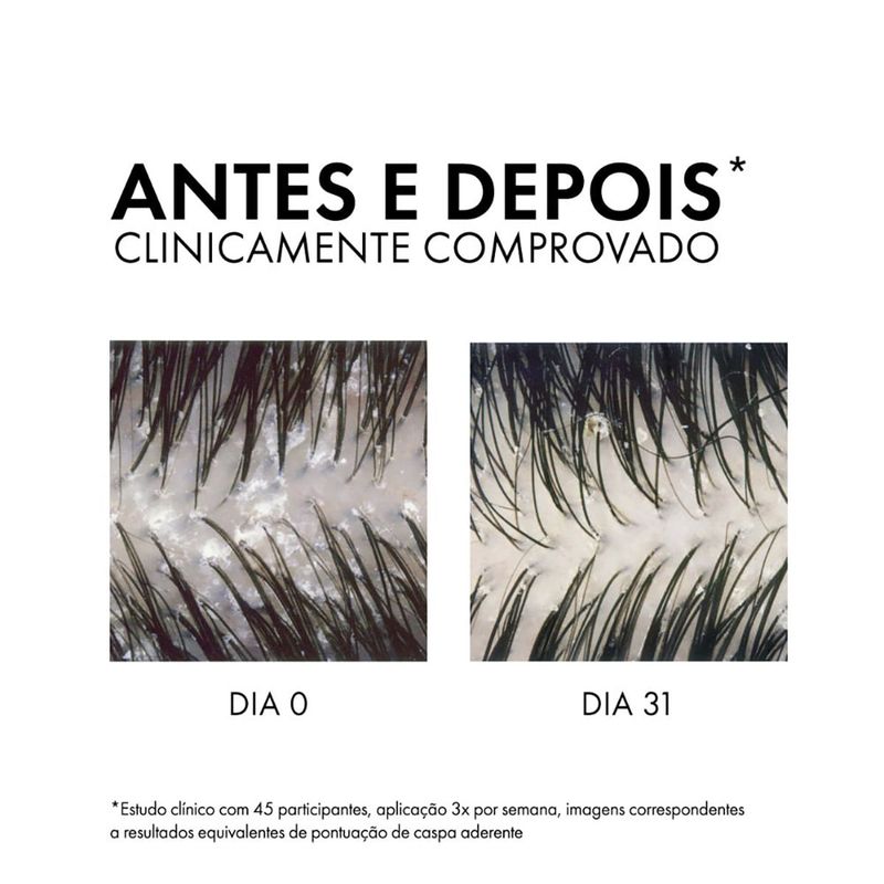 VICHY DERCOS SHAMPOO ANTICASPA CABELO SECO DS 300G