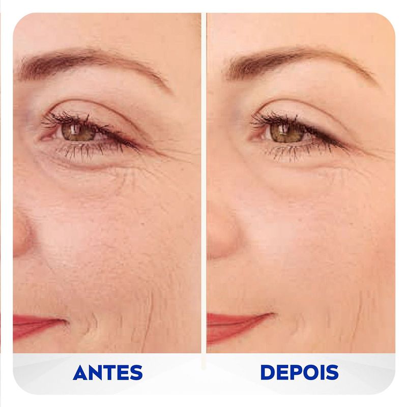 NIVEA Q10 PREENCHEDOR ANTISSINAIS EXPERT 15ML