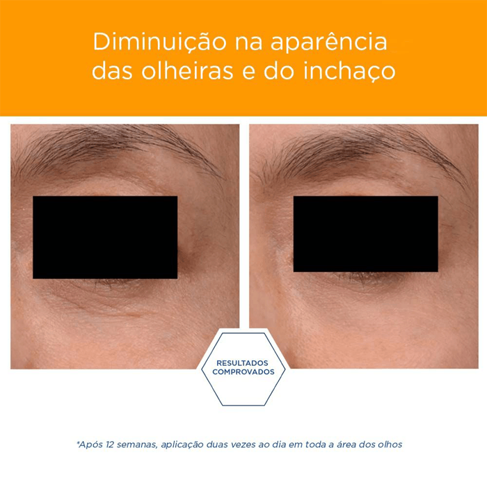 NEOSTRATA BRIGHTENING EYE CREAM 15G