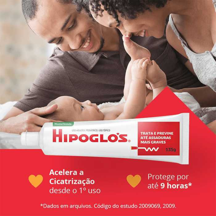HIPOGLOS POMADA 135G